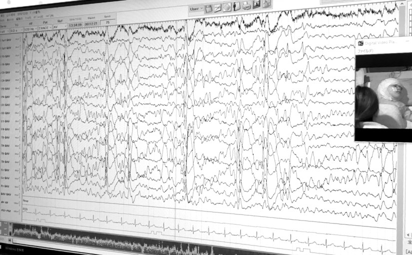 帰国後の脳波の変化